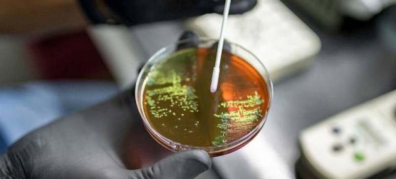 scientists-in-argentina-study-bacteria-samples-to-track-and-control-the-emergence-of-antimicrobial-resistance-amr-7b9c95e168b8afcd751f87b1b3023c191728585429.jpg