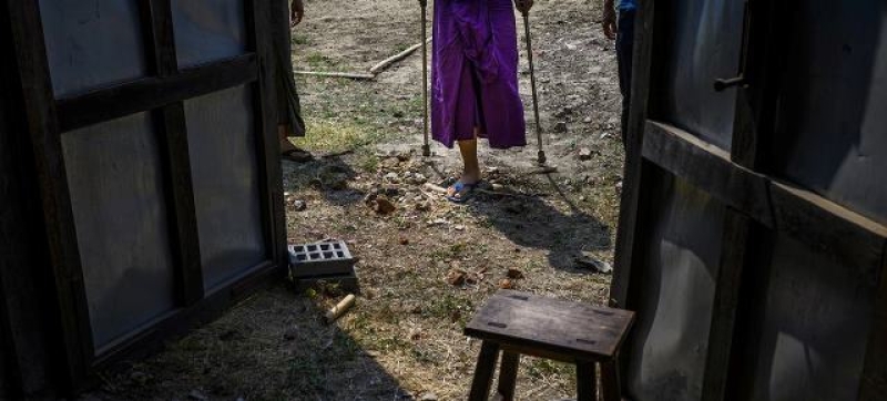 a-child-who-lost-his-left-leg-after-accidentally-stepping-on-a-landmine-in-his-familys-paddy-fields-in-central-myanmar-c1beb8cc821a616b320486c98cd1fef11738301988.jpg