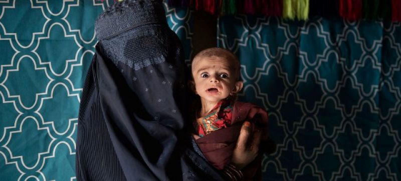 afghan-mother-brings-her-severely-malnourished-7-month-old-baby-to-a-mobile-health-and-nutrition-team-in-a-village-at-maiwand-district-of-kandahar-province-7d54cf0bdc8b3920cc1454726f3c50e11638687405.jpg