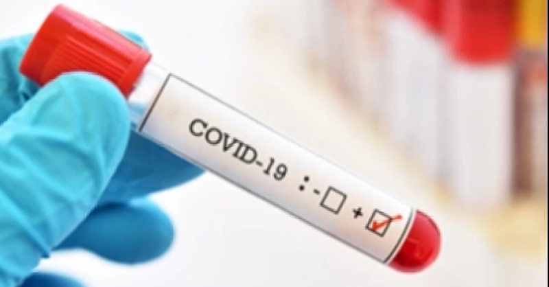 covid-positice-test-result-0e53913c13fafcdd2ab8b669e59282c61685376935.png