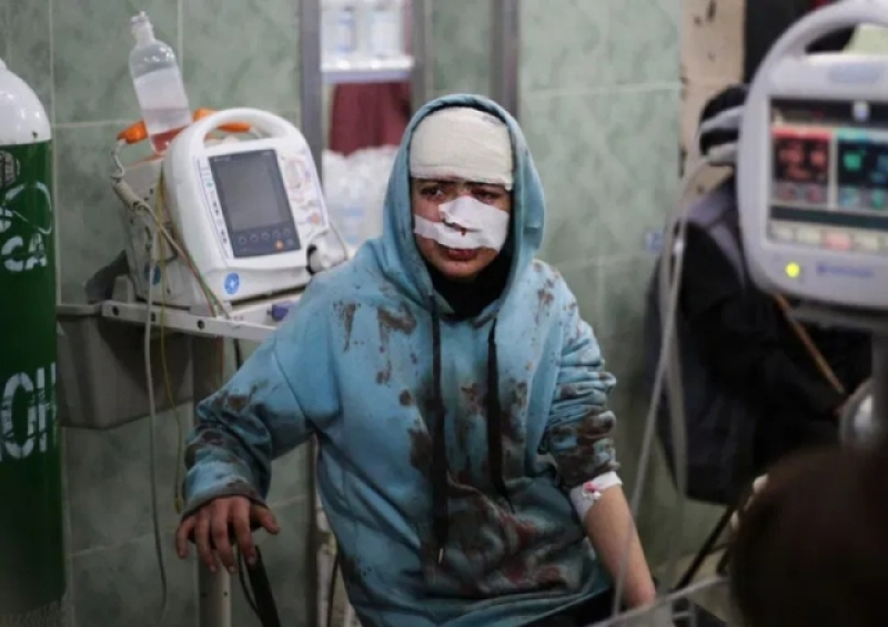 a-palestinian-wounded-in-the-israeli-bombardment-sits-in-a-hospital-in-rafah-gaza-strip-saturday-feb-aa37a1bc28aab2ca834a836c0dbfecab1707667552.jpeg